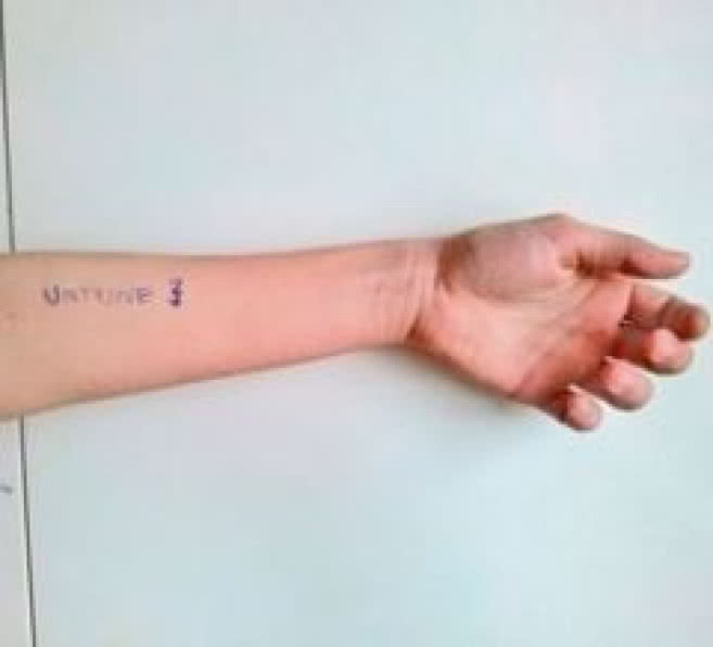 Untune